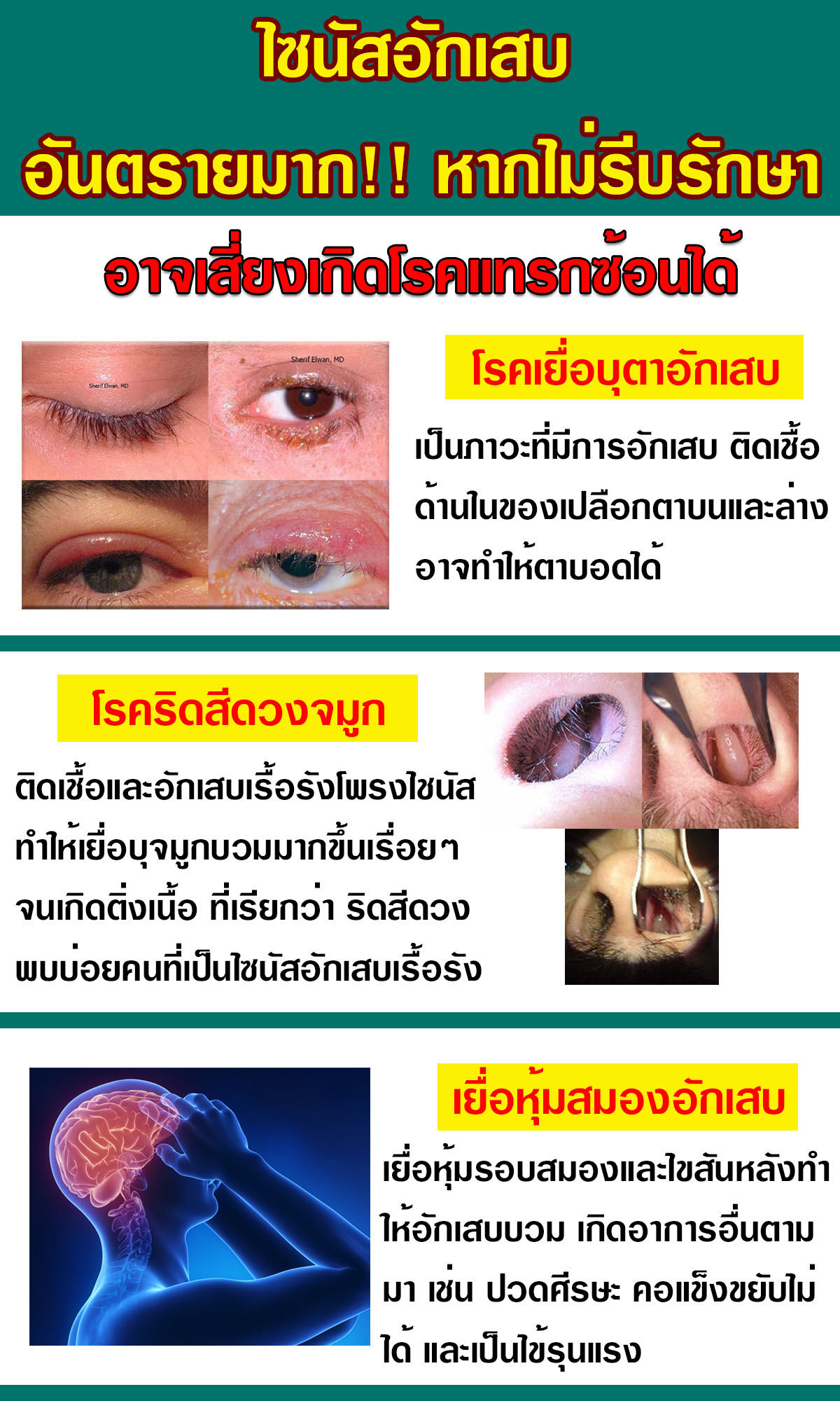 แทรกซ้อน