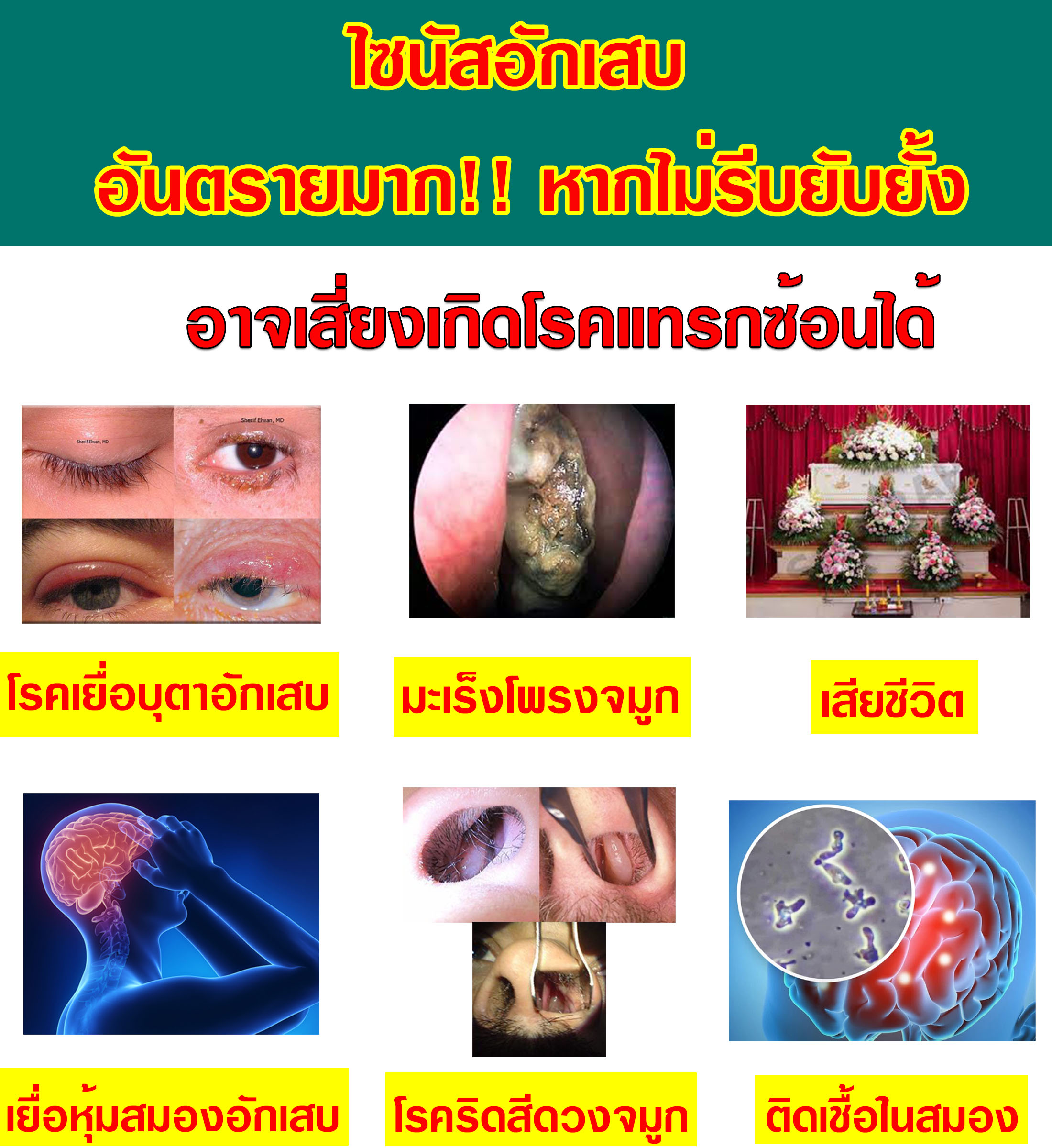แทรกซ้อน11